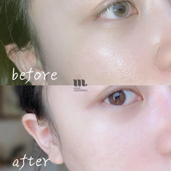 Reveal Radiant Skin with SUR.MEDIC™ Masks! (10pcs)
