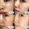 MOMMY CARE PERILLA WHITENING