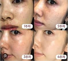 MOMMY CARE PERILLA WHITENING