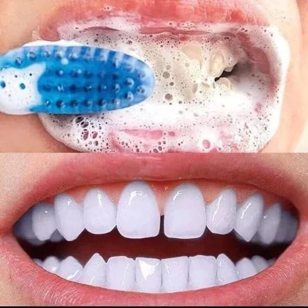 Median Dental IQ 93% Max Fresh Toothpaste (120g)