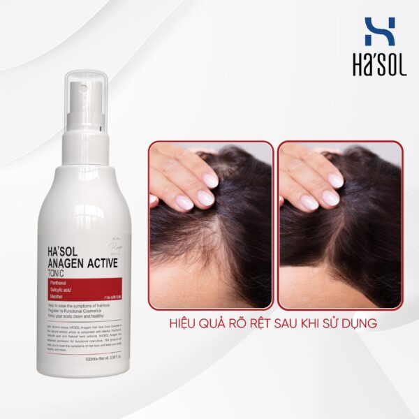 HA SOL HAIR GROWTH SPRAY