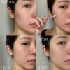 Dr.Jart+ Teatreement™ Soothing Spot Corrector (15ml)