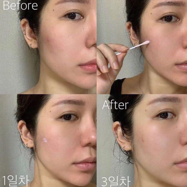 Dr.Jart+ Teatreement™ Soothing Spot Corrector (15ml)